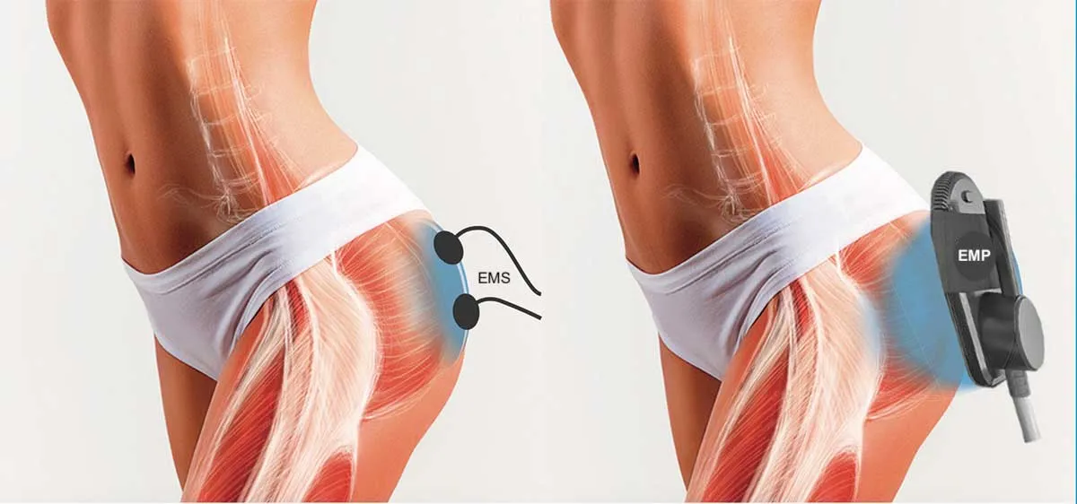 EMP vs EMS Vergleich