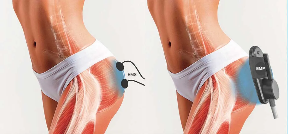 EMP vs EMS Vergleich