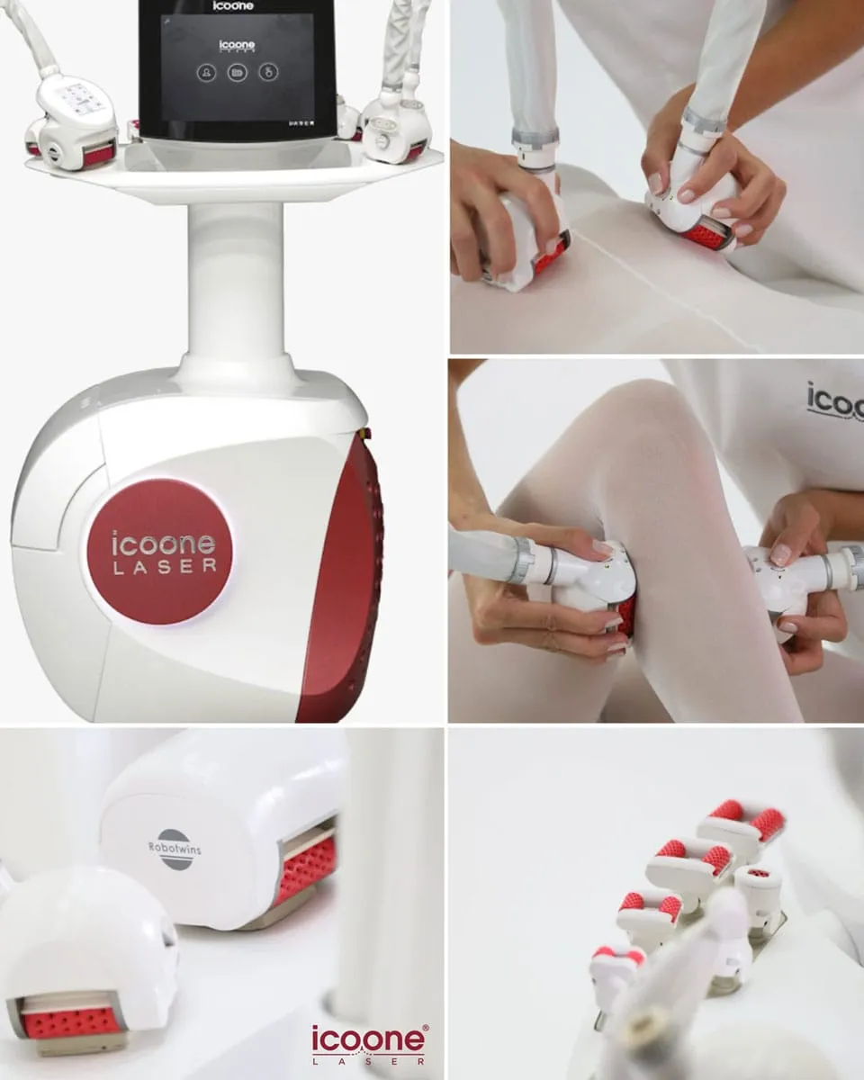 Icoone Laser Behandlung Hannover