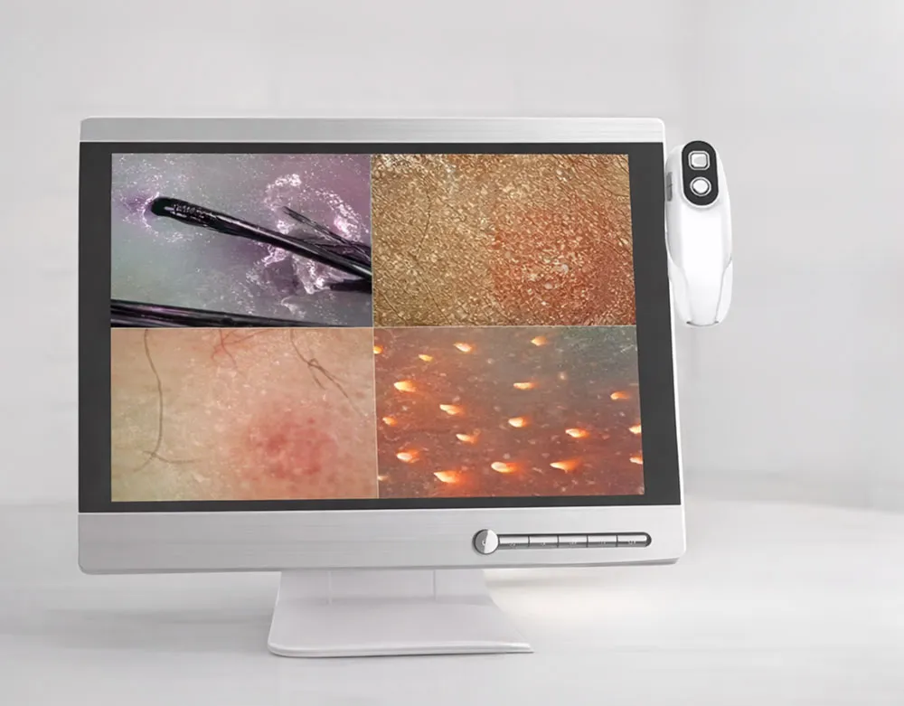 Digitale Hautmikroskopie im Beauty Institut coolini
