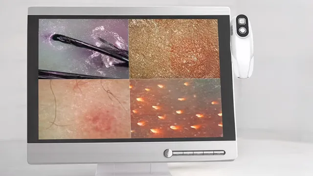 Digitale Hautmikroskopie im Beauty Institut coolini